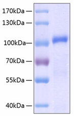 GX00186 Human MMP9