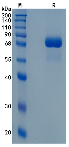GX00208 Human SMPD1
