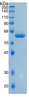 GX00213 Human EPO-R