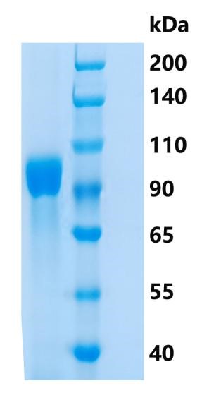 GX00239 Human FGFR4