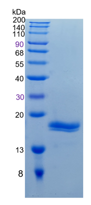 GX00326 Human REG1B