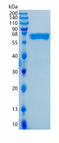 GX00368 Human EFNB1