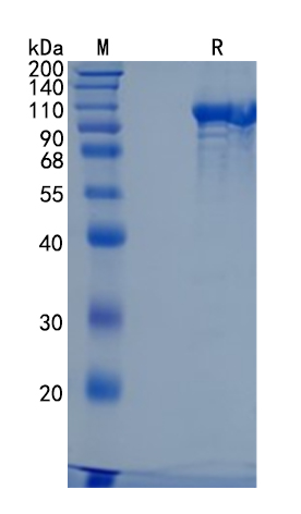 GX00419 Human ENPP2