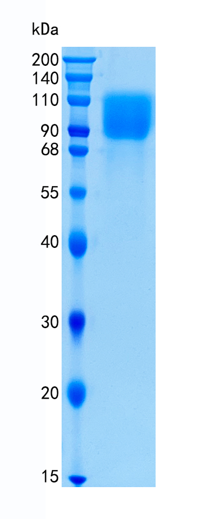 GX00425 Human GPNMB